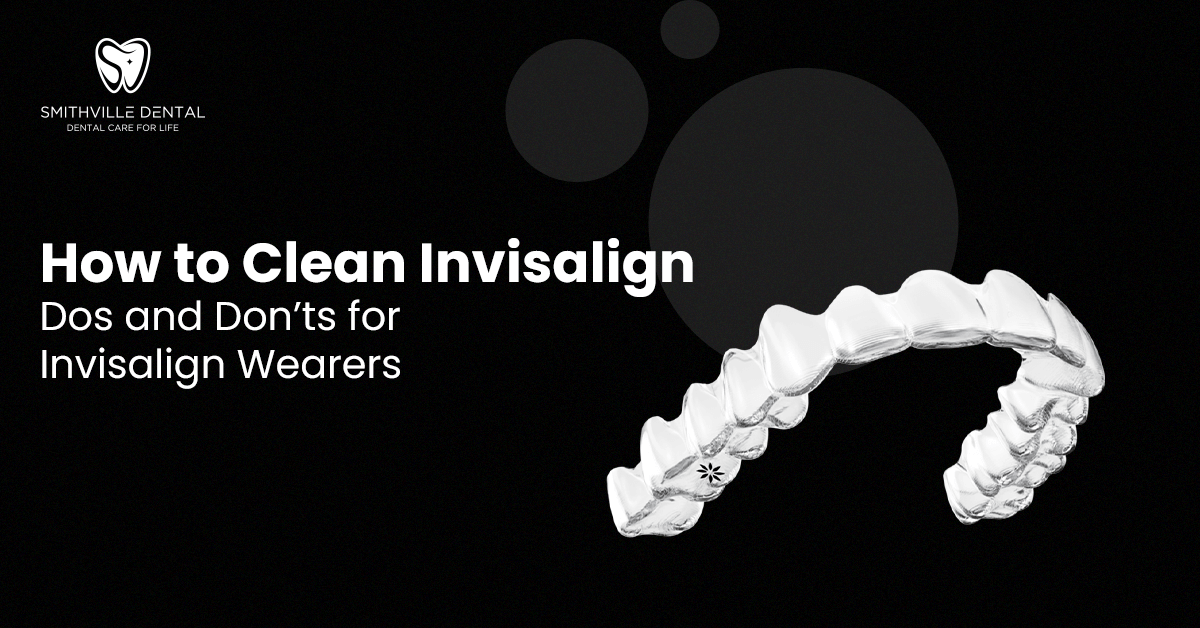 How to Clean Invisalign: Dos and Don’ts for Invisalign Wearers