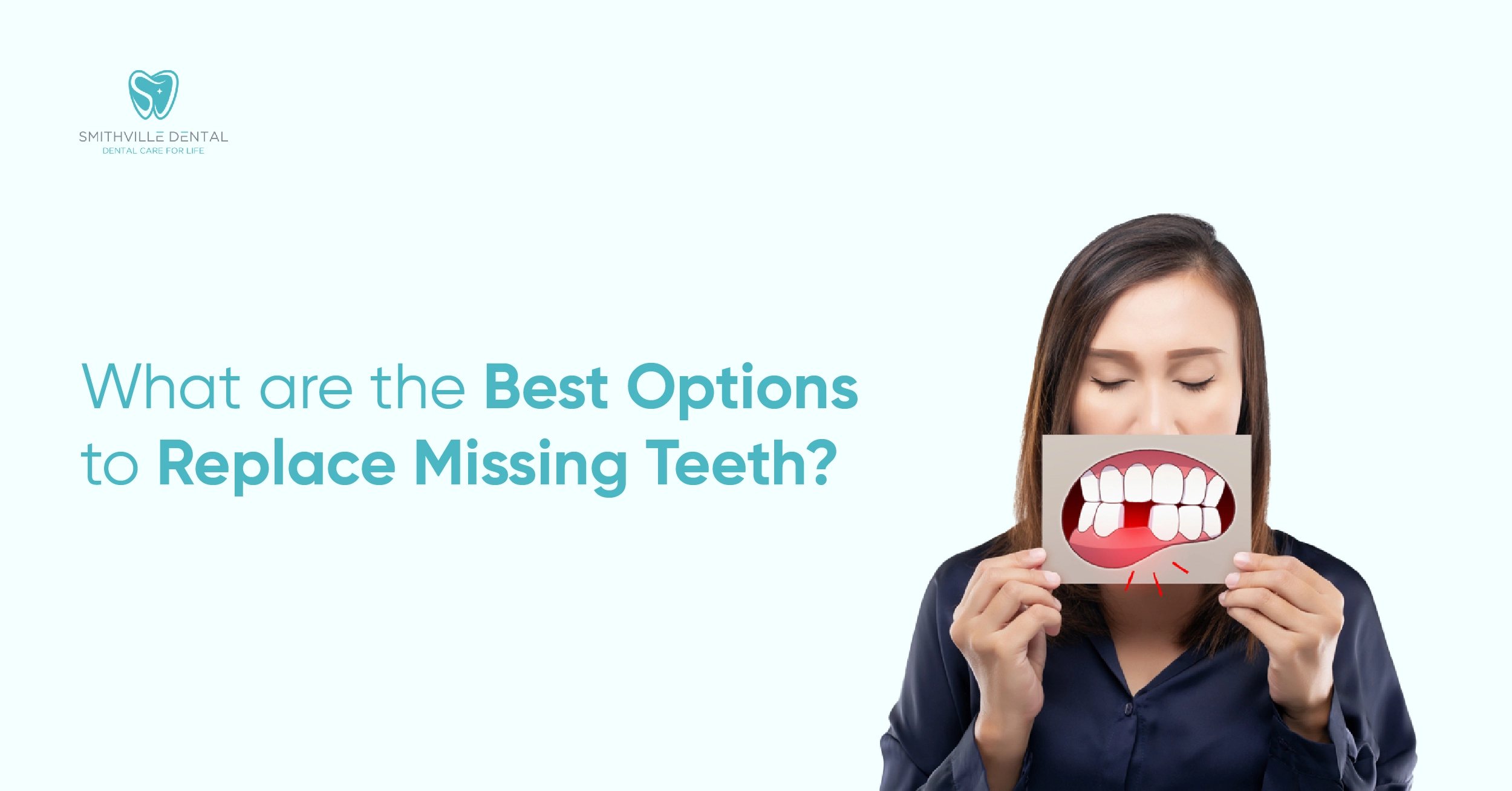 What are the best options to replace missing teeth?